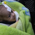 Photo of a newborn Syrian baby wrapped in a blanket, with a bandage on head.